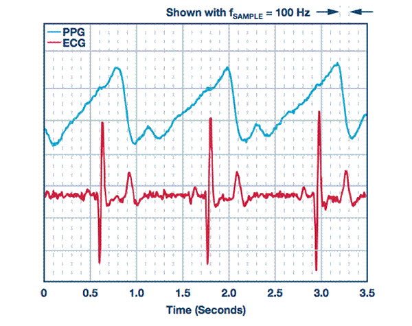 從可穿戴設(shè)備過渡到醫(yī)療設(shè)備 從可穿戴設(shè)備過渡到醫(yī)療設(shè)備