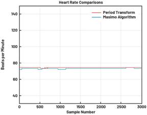 動態(tài)離散周期變換技術(shù)突破：無ECG參考的生理信號精準(zhǔn)解析