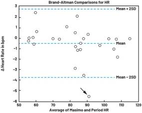 動態(tài)離散周期變換技術(shù)突破：無ECG參考的生理信號精準(zhǔn)解析